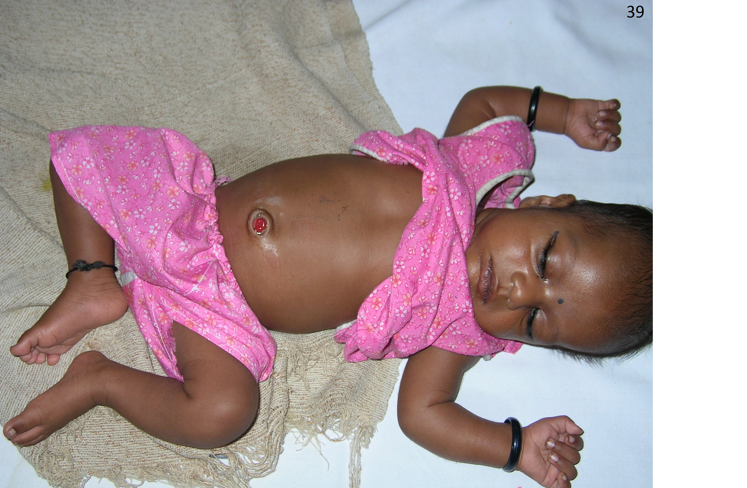 Pediatric G.I. Surgery Image 12